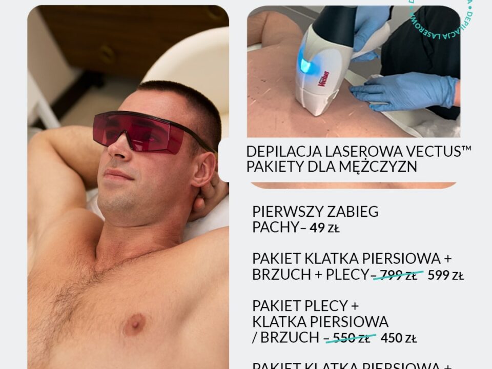 depilacja laserowa dla mężczyzn w Łodzi